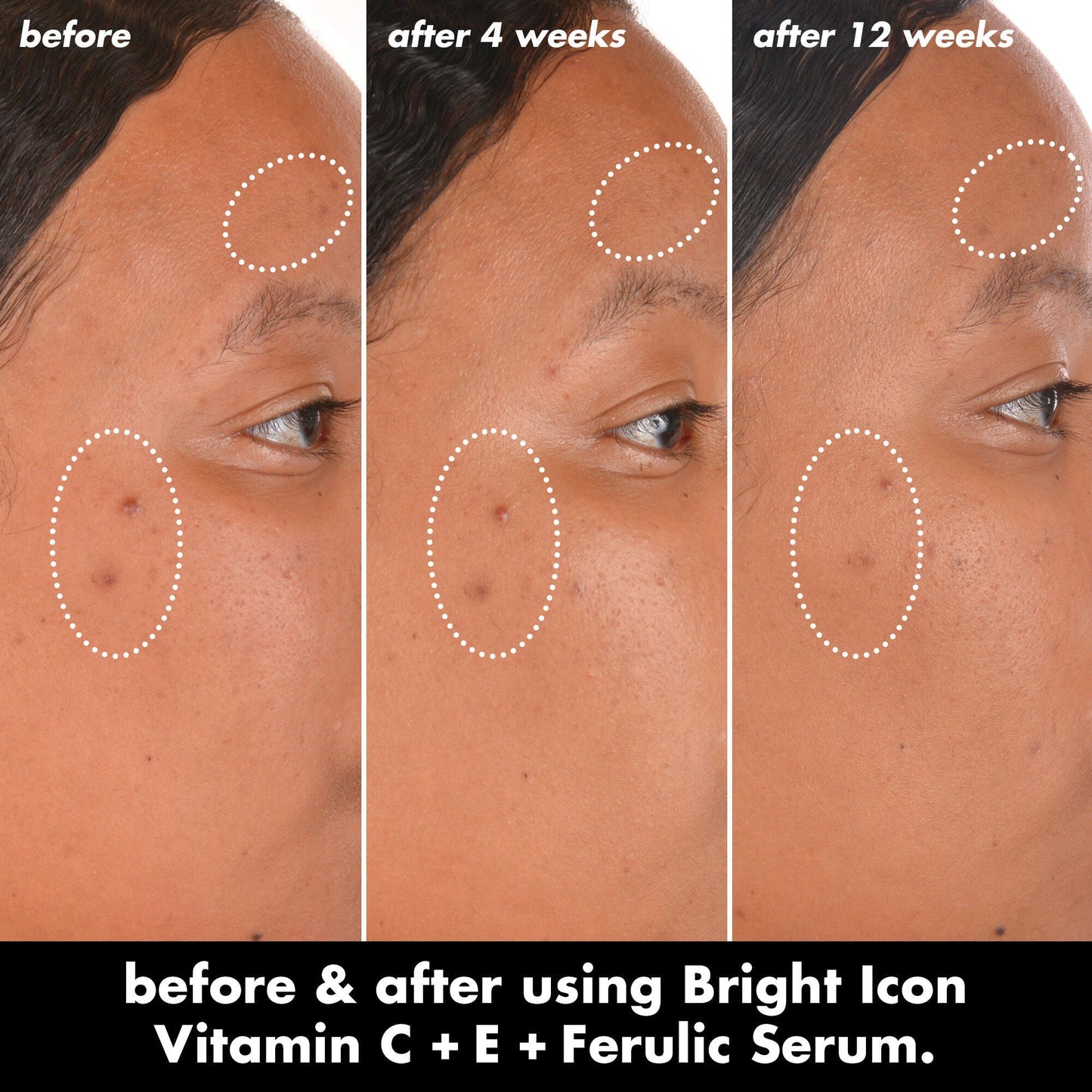 bright-icon-vitamin-c-e-ferulic-serum-o0 0226_EDU_BrightIconVitC_BA_Chanel_TRIPTYCH_c58f2fc8-209d-414f-9ba3-666a07a94887.jpg