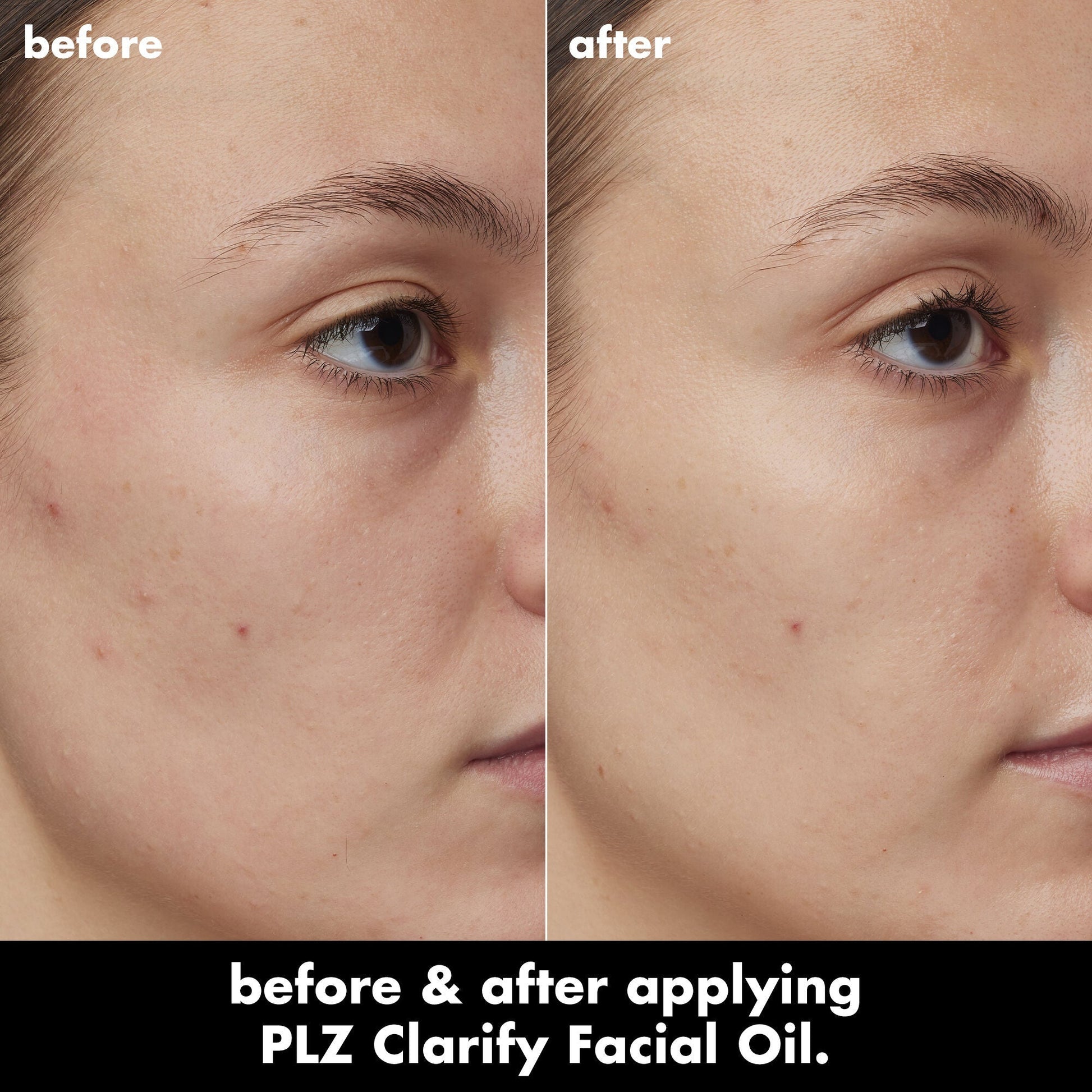 plz-clarify-facial-oil-o7 0326_EDU_PlzClarify_BA_Kelly.jpg