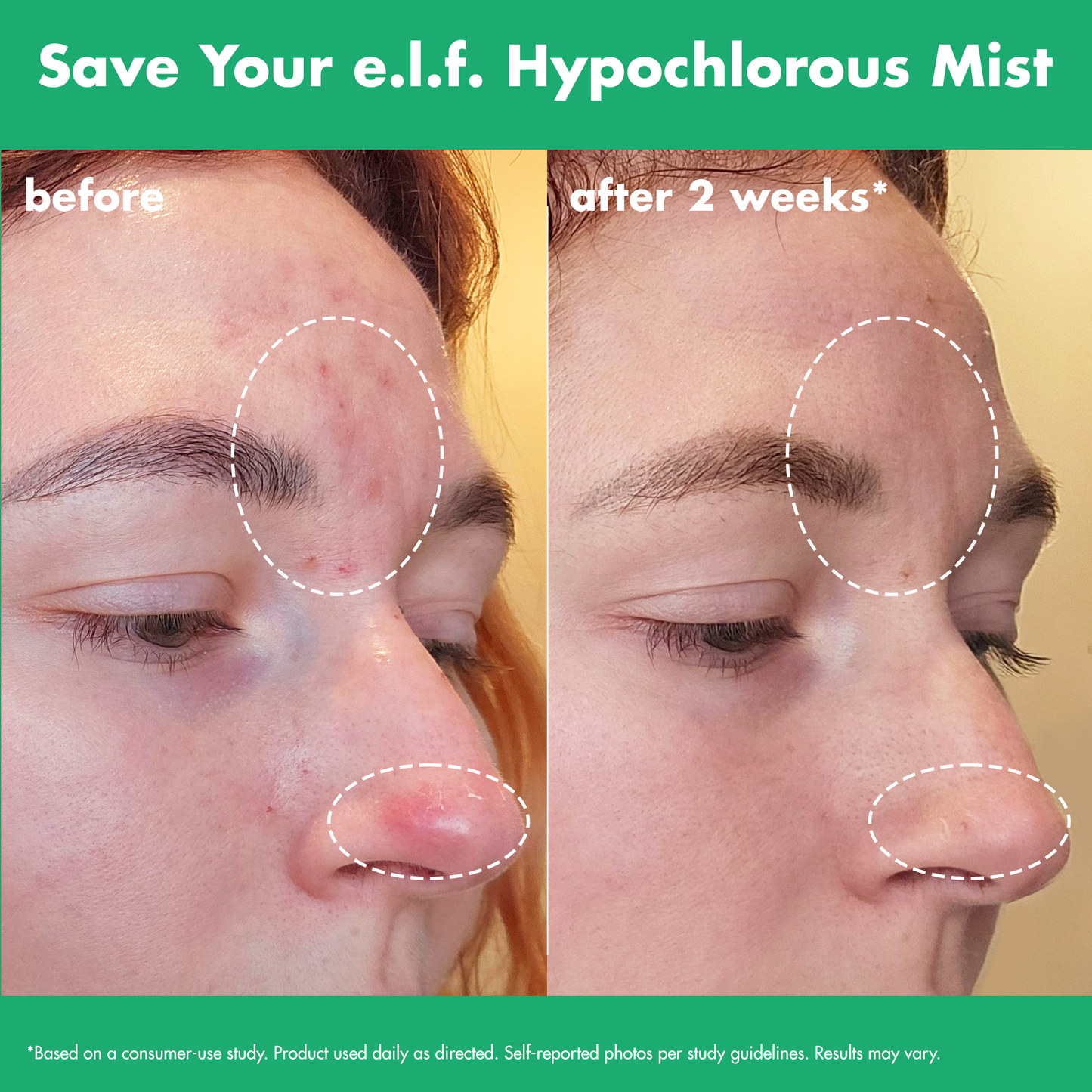 save-your-e-l-f-hypochlorous-mist-f7 FA26_EDUCATION_SAVEYOURELF_USAGE_BA1_WITHOUT_CLAIMS.png