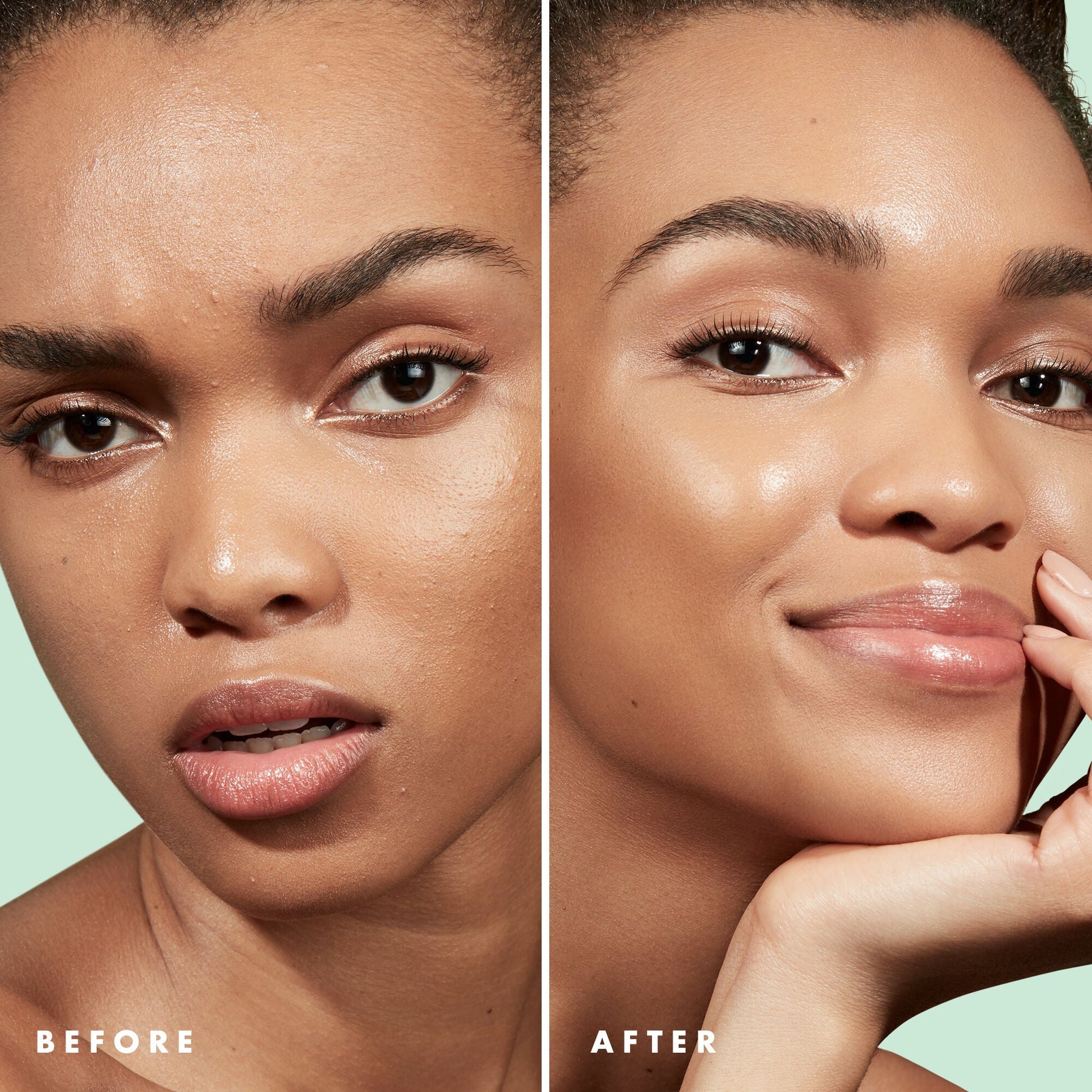 blemish-control-face-primer-small-size-i3 Primer_PP_Before_After_BlemishControl_2000x2000_1b657297-1b62-4427-874a-10c706535581.jpg