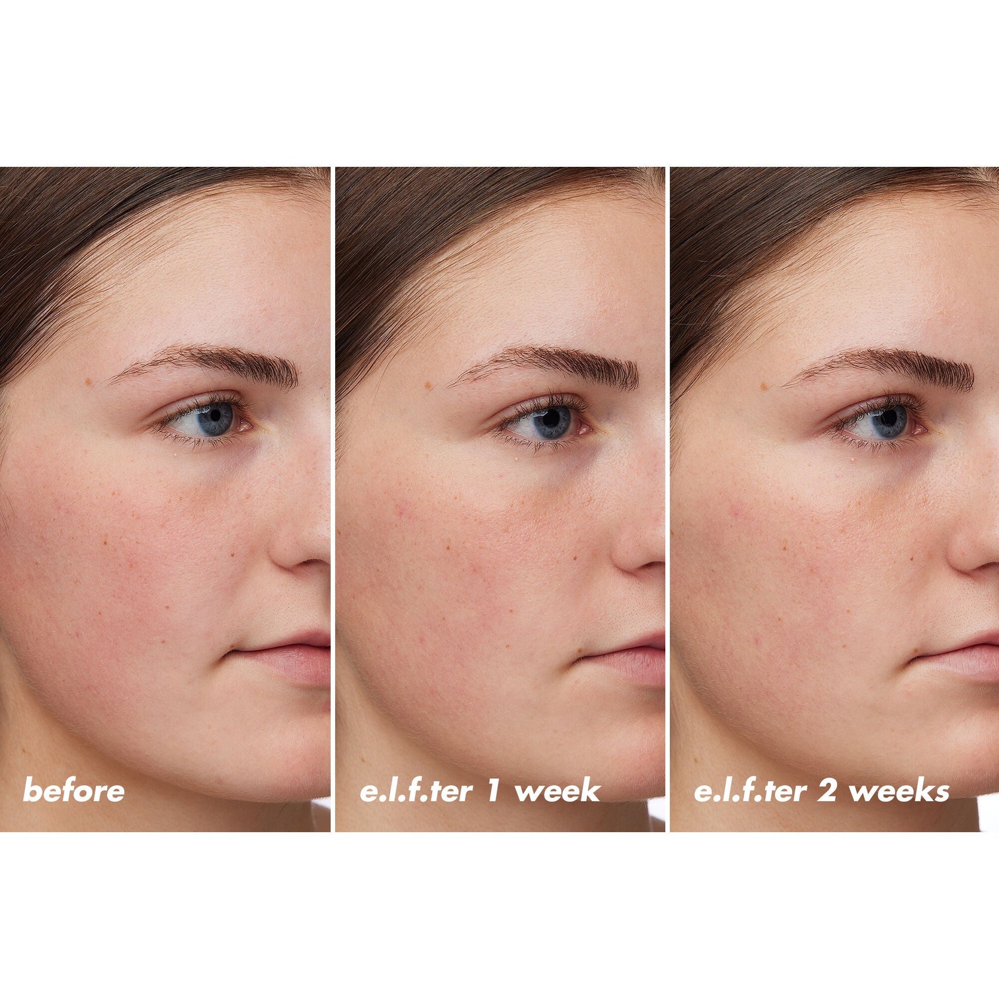holy-hydration-barrier-goals-cream-regular-r0 XX26_EDUCATION_HH-BarrierGoals_B_A_Zoe_TRYPTICH_74c905bd-67bd-4b91-b633-2b01a8905cb8.jpg